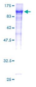SDS-PAGE (F13A1-3609H).jpg